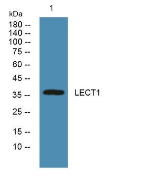 LECT1 rabbit pAb Antibody