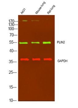PLIN2 rabbit pAb Antibody