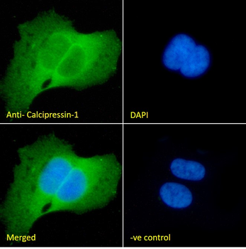 Calcipressin-1 Antibody