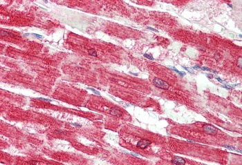 SERCA2/ATP2A2 Antibody