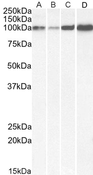 SERCA2/ATP2A2 Antibody