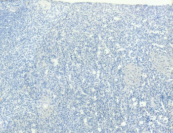 AIF1/IBA1 isoform 1 and 3 Antibody