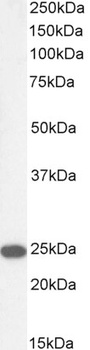 SM22 Alpha/Transgelin Antibody