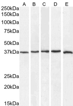 SIRT4 Antibody