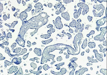 SIRT4 Antibody