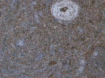 PRDM1/BLIMP1 Antibody