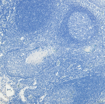 PRDM1/BLIMP1 Antibody