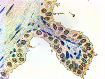 Androgen Receptor Antibody