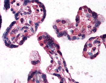 DKK1 Antibody