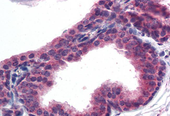 AKT3 Antibody
