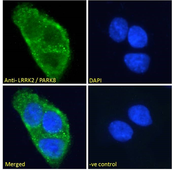 Goat anti-LRRK2 / PARK8 (near C Terminus) Antibody