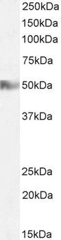 Histamine Receptor H2 Antibody
