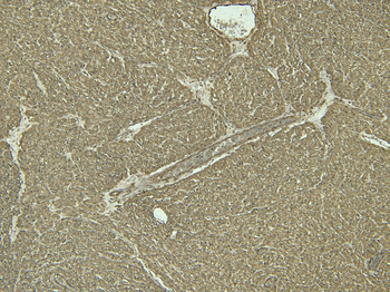 ADRB1 Antibody