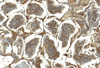 GPX4 (Isoform a and c) Antibody