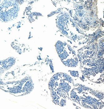 GPX4 (Isoform a and c) Antibody