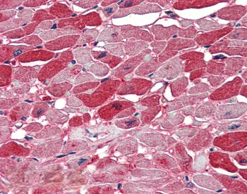 NOVA1 Antibody