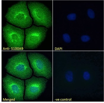 Goat anti-S100A9 Antibody