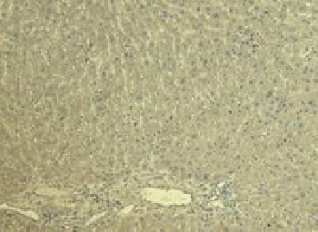 KCNQ1 Antibody