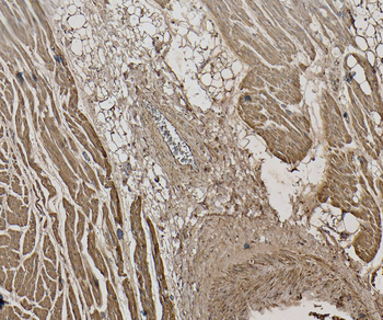 CSX1/NKX2-5 Antibody