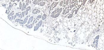 CSX1/NKX2-5 Antibody