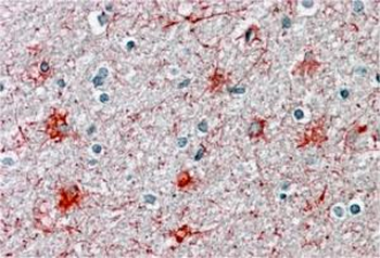 P2RX7/P2X7 receptor Antibody