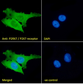 P2RX7/P2X7 receptor Antibody