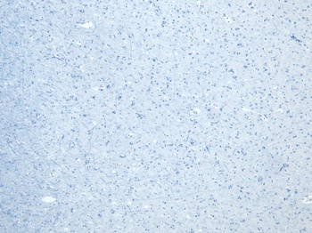Calnexin Antibody