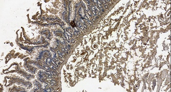 GAL Antibody