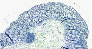 GAL Antibody
