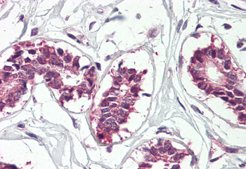 IMP1/ZBP1 Antibody