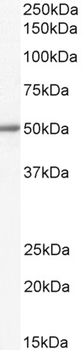 ALDH1B1 Antibody