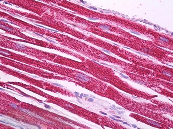 NDUFS1 Antibody