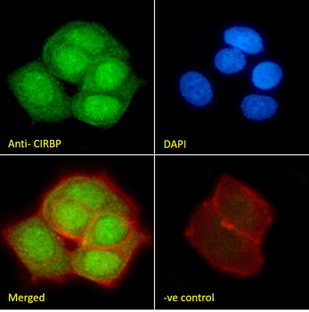 CIRBP (aa 81-91) Antibody
