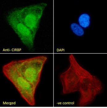CIRBP (aa 81-91) Antibody