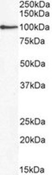 Positive Control Lysate for anti- GPR94 / TRA1 antibody