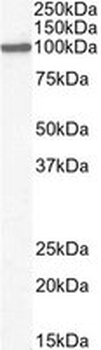 Positive Control Lysate for anti- GPR94 / TRA1 antibody