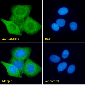 Goat anti-AMHR2 (aa88-99) Antibody