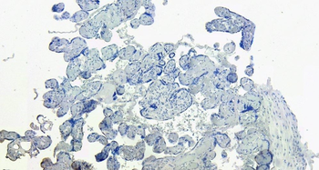 DC-SIGN/CD209 Antibody
