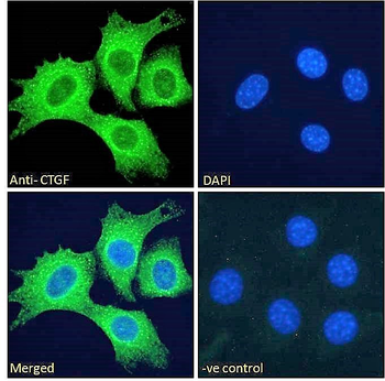 CTGF Antibody