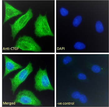 CTGF Antibody