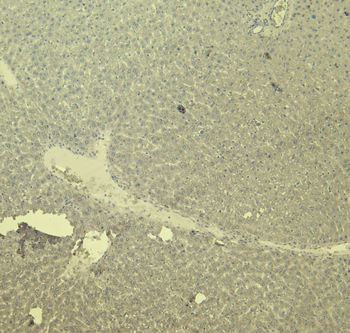 CTGF Antibody