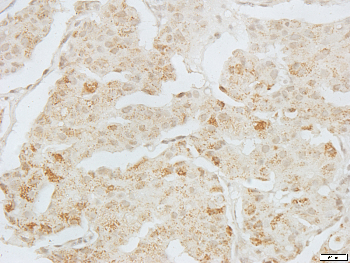 BAX Rabbit Polyclonal Antibody