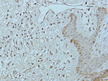 CDK1/2/3 (Phospho-T14) Rabbit Polyclonal Antibody