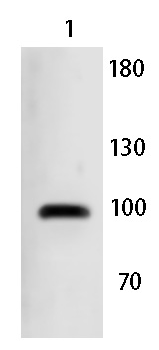 Collagen 6 alpha 2 Rabbit Polyclonal Antibody
