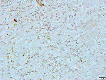 CREB Rabbit Polyclonal Antibody