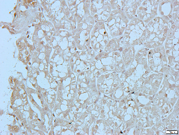 CREB Rabbit Polyclonal Antibody
