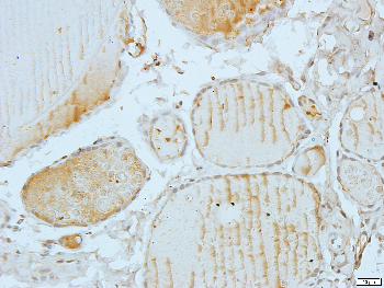 XPO2 Rabbit Polyclonal Antibody