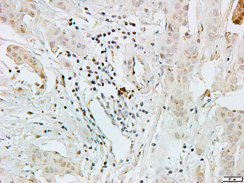 Catenin alpha 1/2 Rabbit Polyclonal Antibody