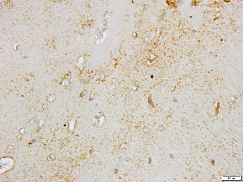 DLX5 Rabbit Polyclonal Antibody