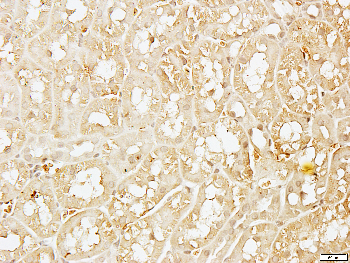 DLX5 Rabbit Polyclonal Antibody